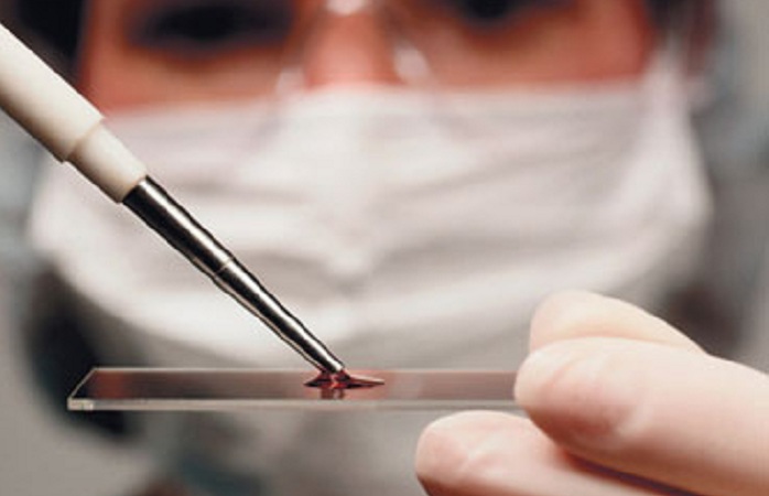Qanunsuz süni mayalanma və tibbi sterilizasiyaya görə cəzalar sərtləşdirilir
